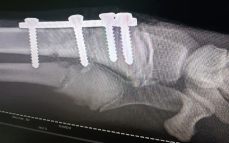 Ortopedija u veterini